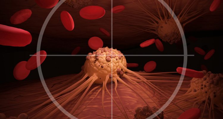 Определение возраста риска рака: когда начинать беспокоиться