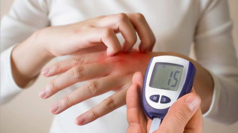 Признаки диабета: как кожа и десны сигнализируют о высоком сахаре